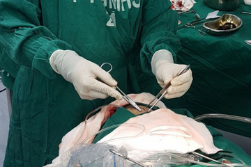 Phẫu thuật cho bệnh nhân bị đạn bắn xuyên tai