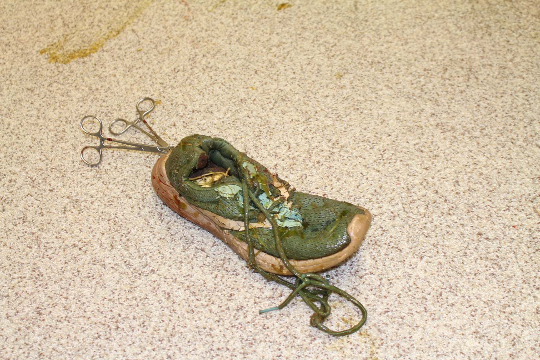 Phẫu thuật hiếm hoi lấy đôi giày khỏi bụng cá sấu