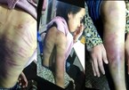 Đôi tình nhân bạo hành, hiếp dâm bé gái 12 tuổi ở Hà Nội bị khởi tố