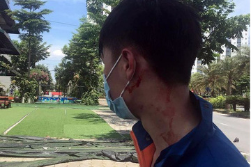 Vụ cướp điện thoại, đâm người giữa ban ngày ở Hà Nội: Công an điều thêm lực lượng đảm bảo an ninh