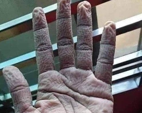 Cách chăm sóc da tay khi đeo găng tay y tế nhiều giờ