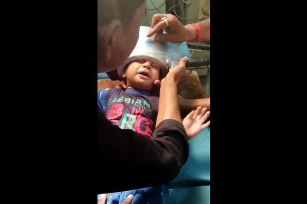 Bác sĩ ‘toát mồ hôi’ giải cứu cậu bé bị kẹt đầu trong nồi áp suất