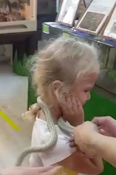 Thăm quan sở thú, cô bé 5 tuổi bất ngờ bị rắn cắn vào mặt