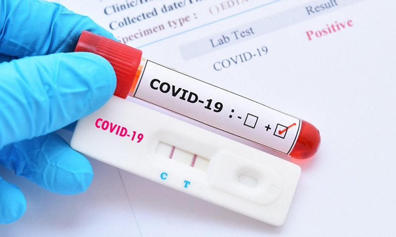 Đồng loạt giảm giá dịch vụ xét nghiệm Covid-19 từ ngày 21/2