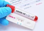 Đồng loạt giảm giá dịch vụ xét nghiệm Covid-19 từ ngày 21/2