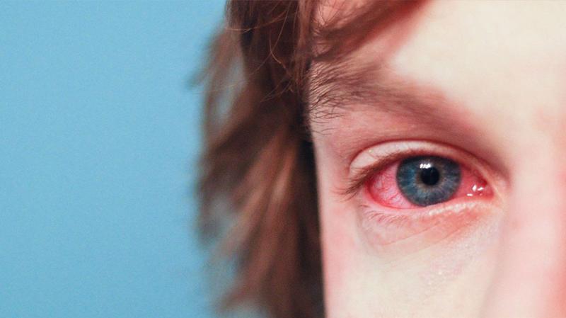 Nữ bệnh nhân 21 tuổi mù mắt chỉ vì thói quen nhiều người hay làm