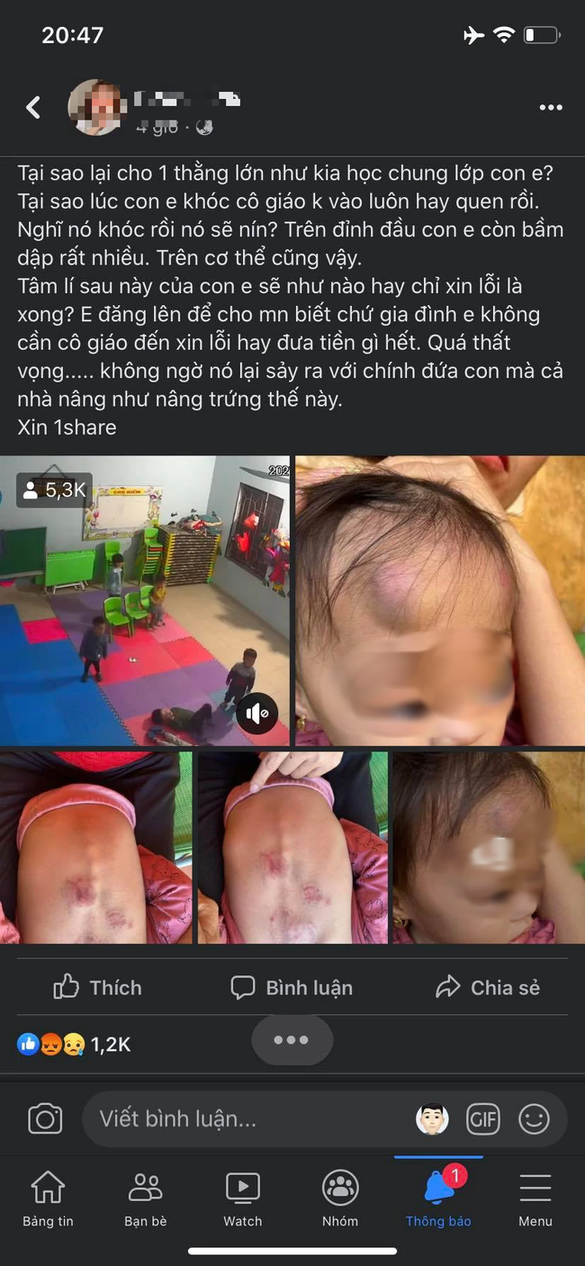 Bé gái 2 tuổi bị bạn học đánh ở Bắc Giang: Ảnh hưởng tâm lý mới là điều đáng lo!