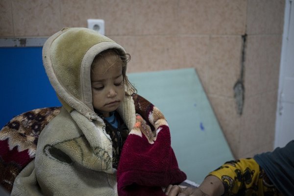 Bé gái 2 tuổi không đủ sức mở mắt và nạn đói khủng khiếp ở Afghanistan