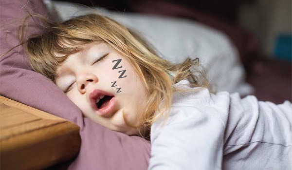 Vì sao trẻ béo phì, viêm amidan hay gặp ngừng thở khi ngủ?