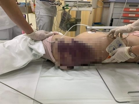 He lộ thêm tình tiết 2 'ác quỷ' tra tấn bé gái 8 tuổi tử vong: Nguyễn Trung Kim Thái còn tàn ác hơn dì ghẻ