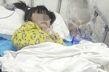Bé gái có nguy cơ phải cắt cụt cả 2 chân vì bị bố và bạn gái bạo hành dã man