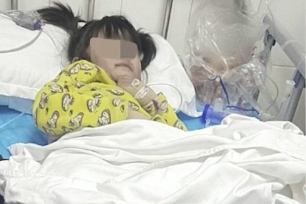 Bé gái có nguy cơ phải cắt cụt cả 2 chân vì bị bố và bạn gái bạo hành dã man