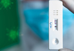 F0 điều trị tại nhà làm xét nghiệm thế nào, có cần xét nghiệm PCR không?