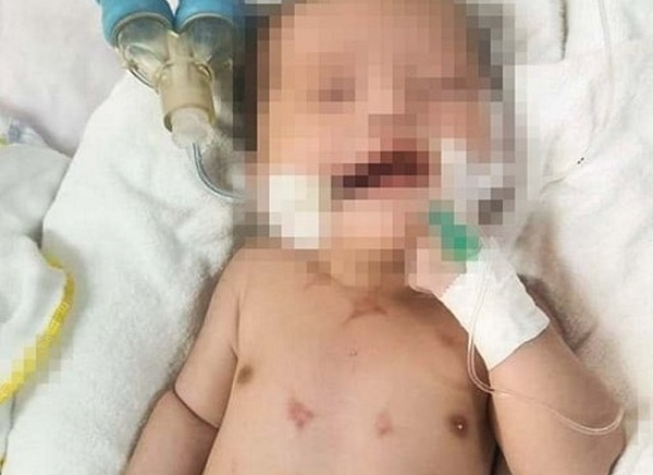Nghệ An: Bé sơ sinh bị suy hô hấp, nhiễm trùng máu vì xông than, lễ đẹn