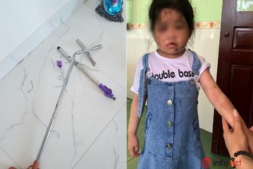 Hà Tĩnh: Bé gái 4 tuổi trở lại lớp học, giáo viên phát hiện trên người đầy vết tím bầm, sưng tấy