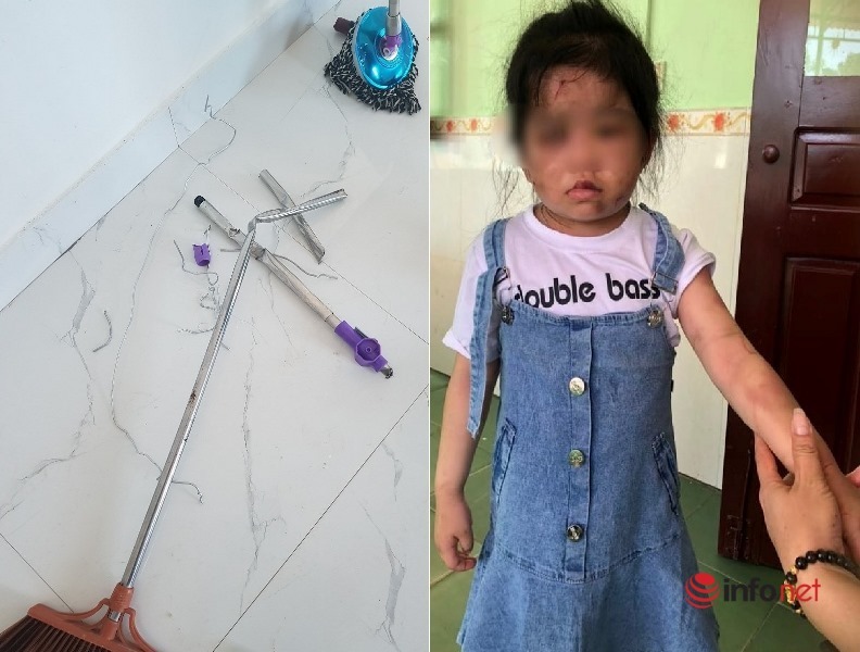 Ha Tinh: The aunt who abused her 4-year-old granddaughter was held in criminal custody