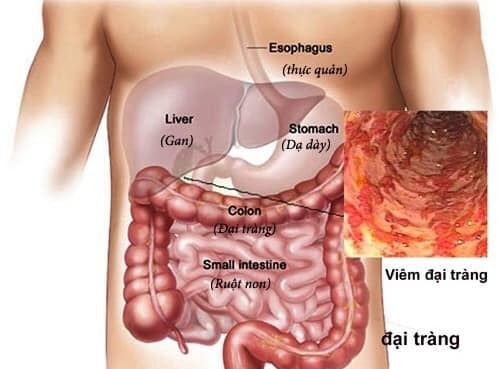 Colon detox from another doctor’s perspective