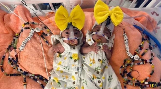 Rare: Twins born 3 days apart