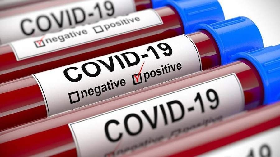 Số ca mắc Covid-19 trên thế giới tăng 30% trong hai tuần
