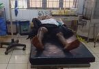 Chính thức khởi tố nam thanh niên châm lửa đốt 2 chân cháu bé 8 tuổi ở Đắk Lắk
