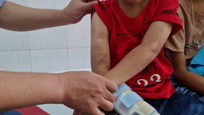 Khởi tố bà nội và cha ruột trong vụ cháu bé 9 tuổi bị đánh ở Đắk Lắk