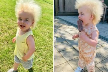 Mắc bệnh lạ, bé gái có mái tóc bù xù giống hệt nhà khoa học Albert Einstein