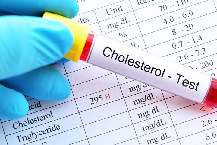 Vì sao cholesterol được coi là 'tội đồ' sức khỏe của con người?
