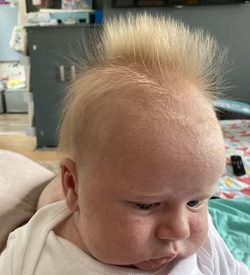 Cậu bé 10 tuần tuổi bất ngờ nổi tiếng khắp mạng xã hội vì mái tóc độc nhất vô nhị