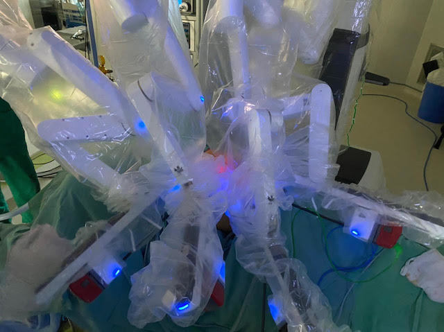 Không phải đi Mỹ, Nhật, tại BV K, bệnh nhân cũng được phẫu thuật Robot điều trị ung thư thận