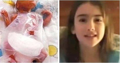 Hình ảnh xinh đẹp sau 14 năm của cô bé nhỏ nhất thế giới khi sinh ra chỉ 260 gam